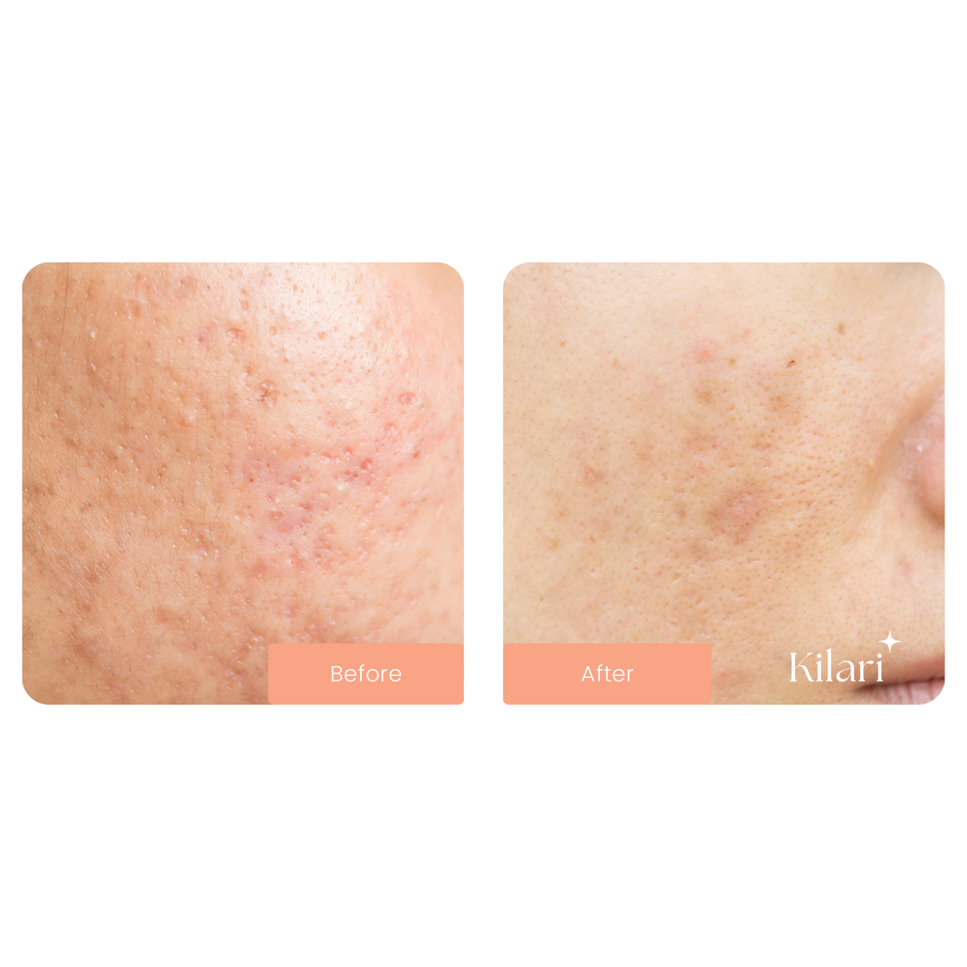Kilari Ultimate Glow Kit