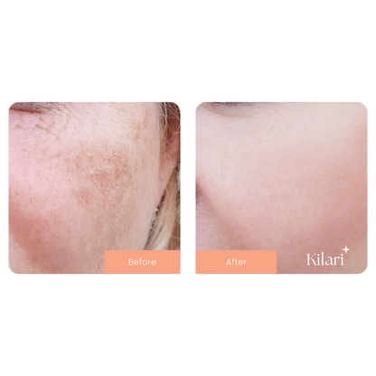 Kilari Ultimate Glow Kit