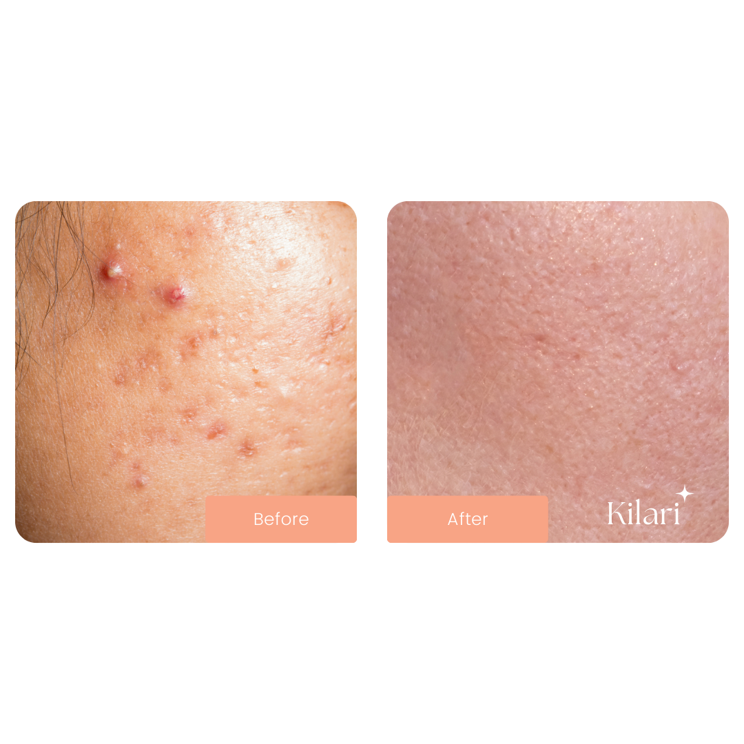 Kilari Ultimate Glow Kit