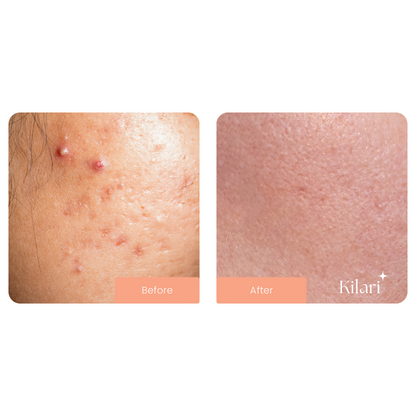 Kilari Ultimate Glow Kit
