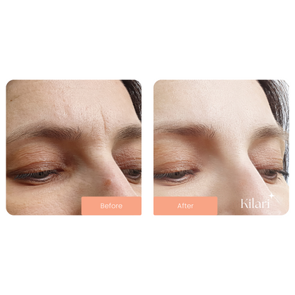 Kilari Ultimate Glow Kit